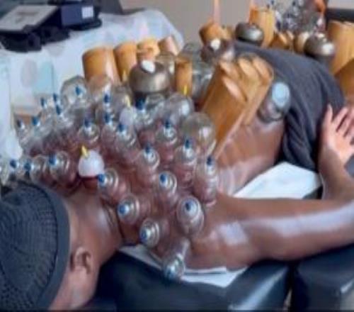 神秘東方力量吉拉西上周拔火罐背部大腿密密麻麻，周末聯(lián)賽雙響