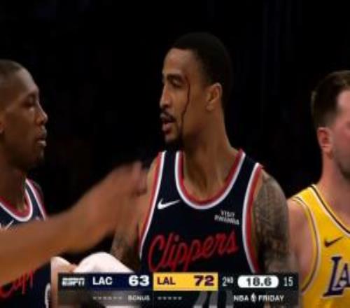 沒(méi)有大礙就好！約翰科林斯：我縫了幾針但感覺(jué)還不錯(cuò)