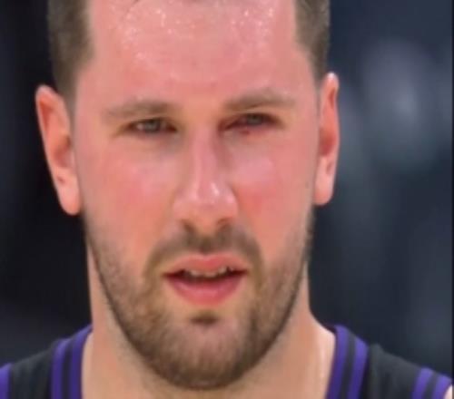 很危險(xiǎn)！東契奇拿球時(shí)被大瓦格納戳到眼睛傷口明顯