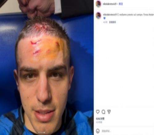 補時最后時刻造點！克爾斯托維奇社媒曬傷口照：很快球場再見！