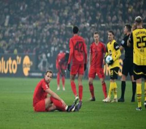 孔帕尼：凯恩因小腿撞伤无缘出战门兴，但伤势不严重