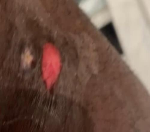 詹姆斯自拍展示右腿上的傷口：可能是年度最佳撲球造成的！好痛！