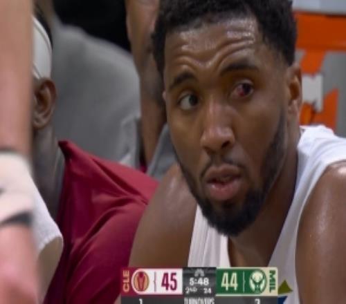 米切爾：我的左眼幾乎看不見得分能力不行想在其他方面幫助球隊(duì)