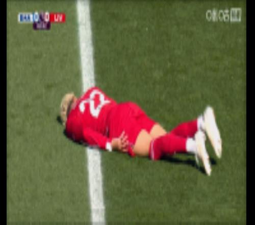 博主：?；倏梭y部受傷起初會很疼，但預計恢復時間不超過一周