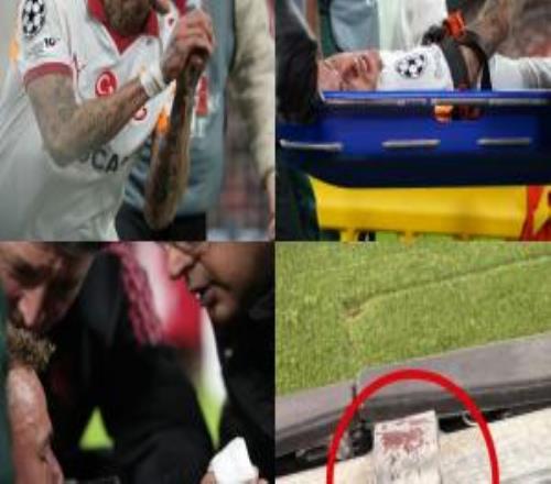 手指幸运保住！TA：诺阿朗的大拇指不用截肢，但伤势严重