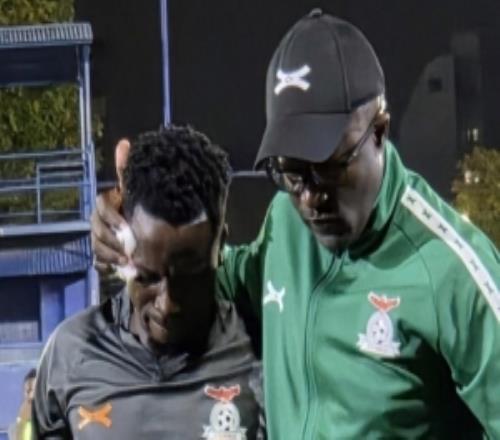 阿媒：贊比亞中場(chǎng)普林斯蒙巴訓(xùn)練中受傷，可能趕不上出戰(zhàn)阿根廷