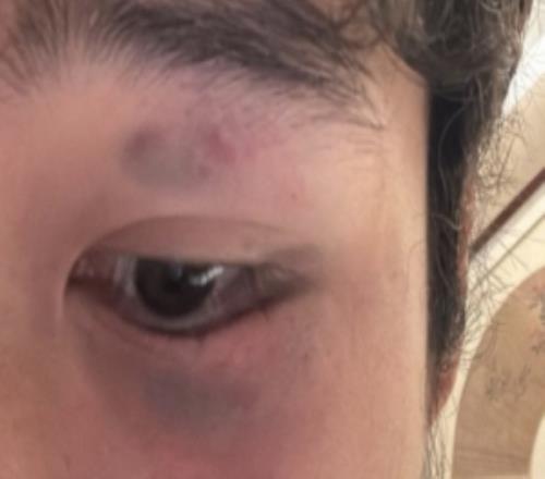 阮奇龙报平安：当时出现头晕呕吐，所以队医要求前往医院