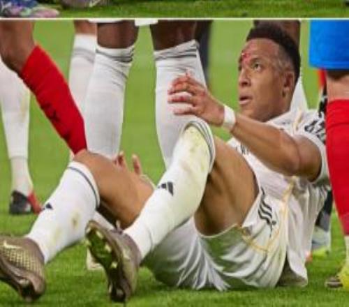 血跡明顯！姆巴佩臉部被對手打到后眼角流血，裁判最終未判點