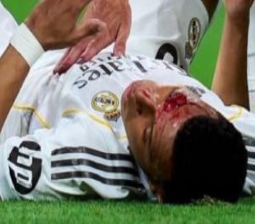 龍賽羅曬姆巴佩流血照：這就是西班牙裁判，內(nèi)格雷拉仍在操控一切