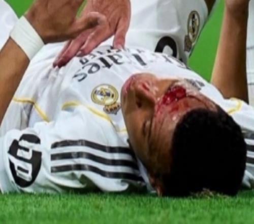 阿斯報：西甲方面否認(rèn)轉(zhuǎn)播故意不拍姆巴佩流血鏡頭