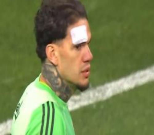 別拍了埃德松被看臺異物劃傷面部，起身后怒錘貼臉拍的攝像機(jī)