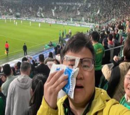 在看臺被球擊中！眼鏡被砸斷的國安球迷：國安通知我去領(lǐng)簽名球衣