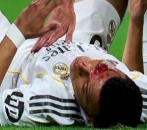 阿斯報(bào)：姆巴佩將首發(fā)出戰(zhàn)拜仁，他不會佩戴面具