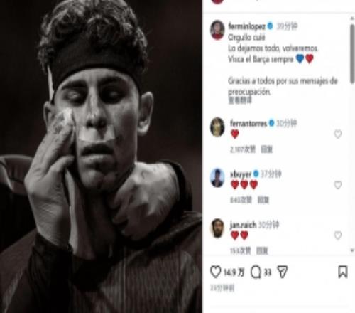 费尔明晒脸部受伤照片：我们已倾尽全力，感谢大家的关心