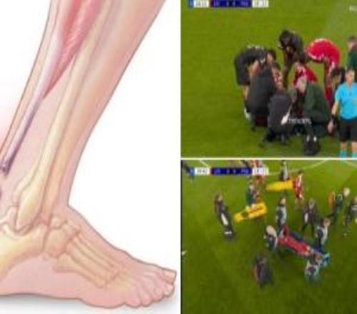 世界杯危！康復(fù)專家：?；倏丝赡苁歉鞌嗔?，將缺席912個月