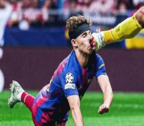 看著就疼！費爾明被穆索踢到頭部，后又倒地撞向地面，當場血崩