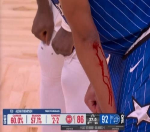 真拼命了！貝恩在等待罰球時(shí)左手臂有磕碰&鮮血直流！