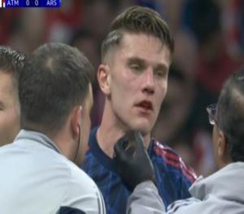 自己人??！約克雷斯?fàn)帗屩心槻勘获R杜埃凱“肘擊”，嘴唇流血