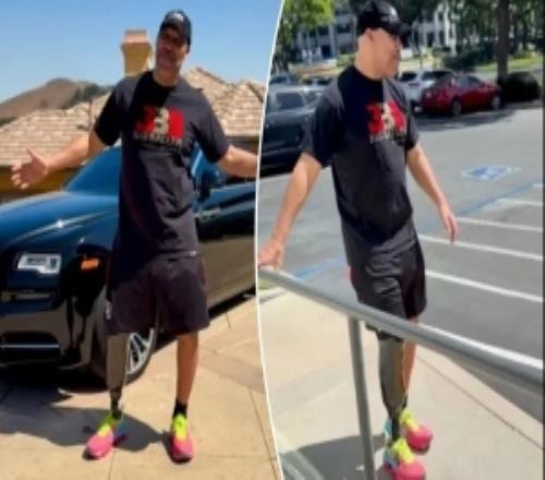 球爹谈被截肢：只要我脖子以上还能思考那就没事能激励残障人士